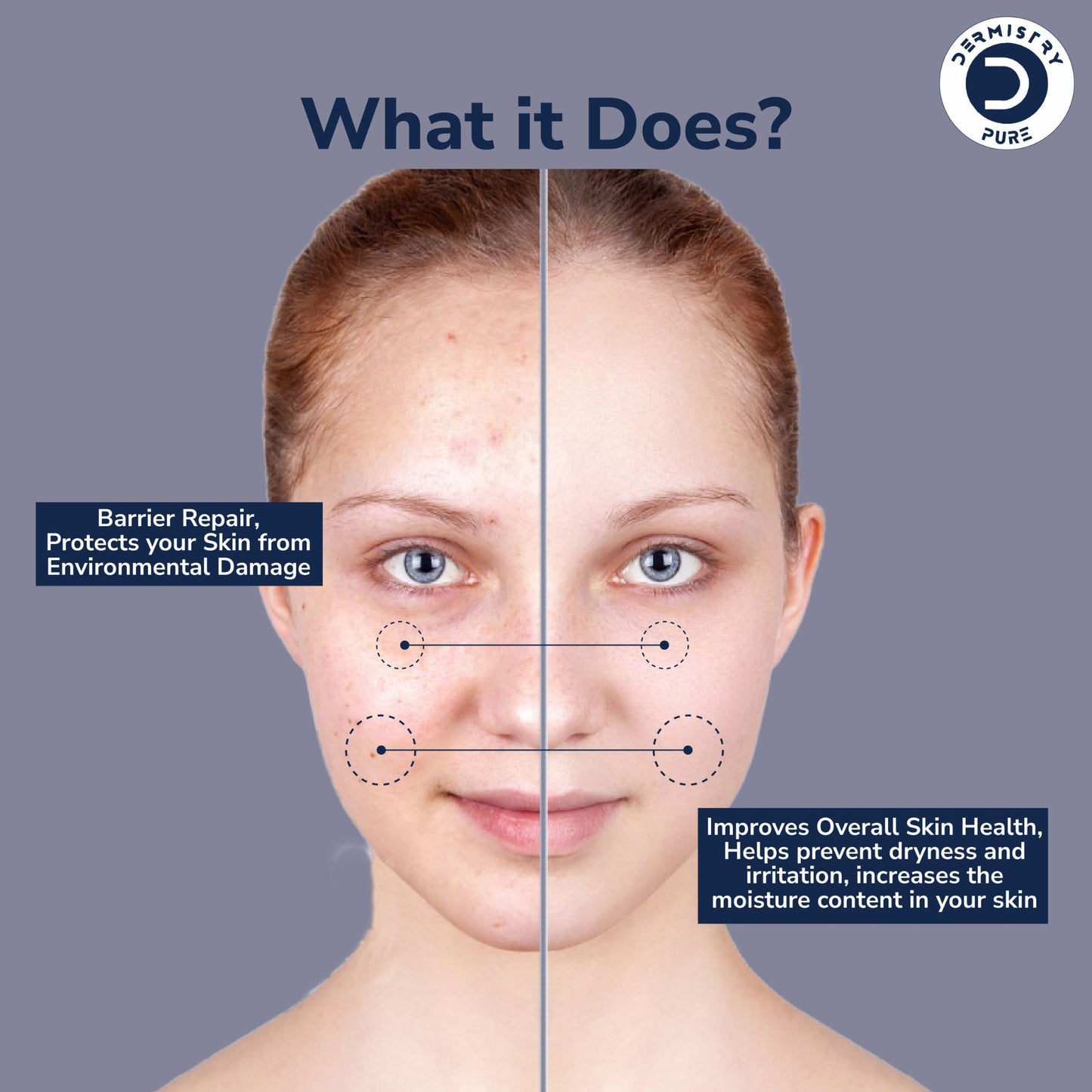 Dermistry Pure 1% Ceramide 2% Hyaluronic Acid Sensitive & Dry Skin Moisturizer Barrier Repair Serum, 30ml