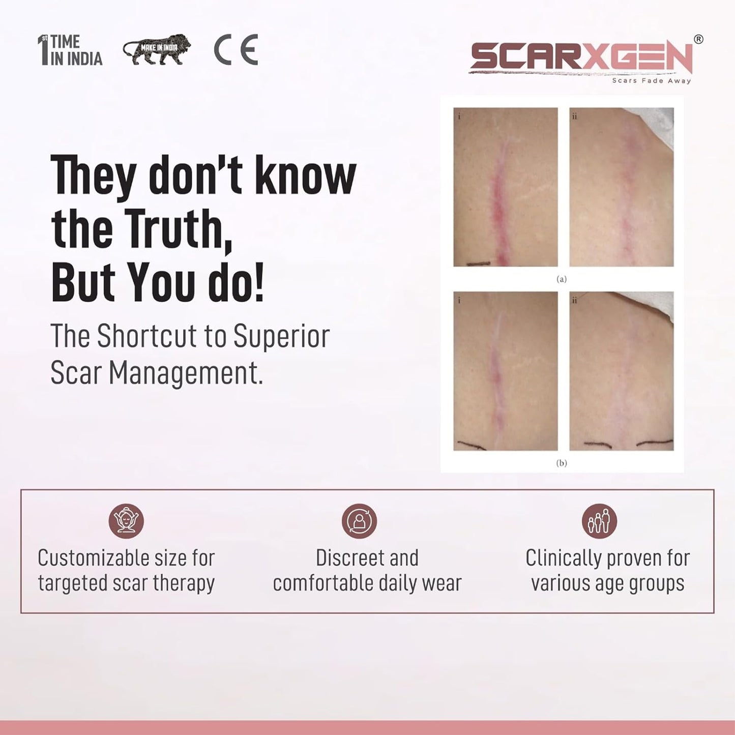 Scarxgen Silicone Gel Sheet 5CmX5Cm (Box Of 2 Units)