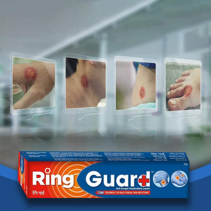 Ring Guard, 20gm
