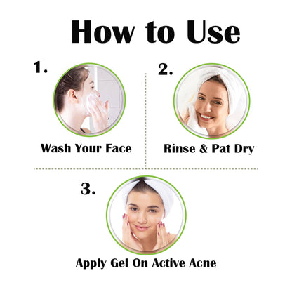 Vigini 35% Actives Anti Acne Pits Scar Spot Stop Face Gel Oily Prone Skin SPF 30, 20ml