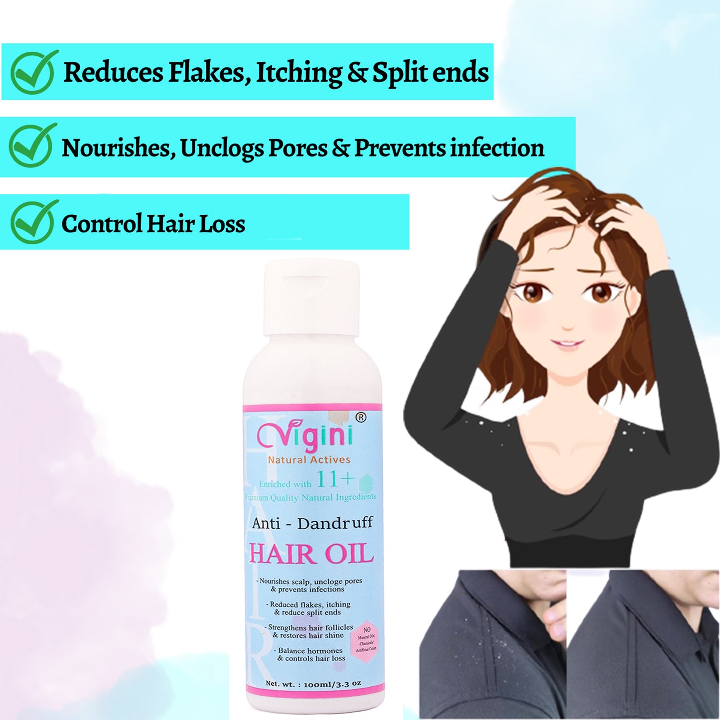 Vigini Anti-Dandruff Pre Shampoo Hair Oil, 100ml