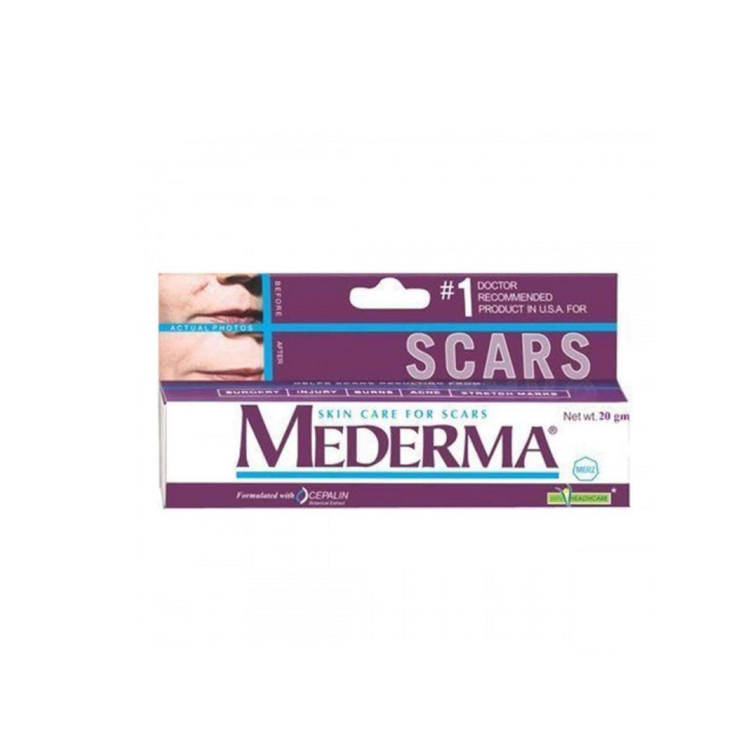 Mederma Skin Care For Scars, 20 gm